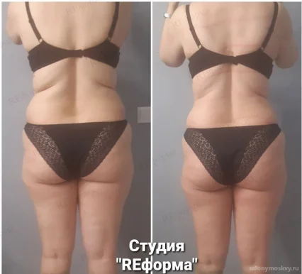 Студия коррекции фигуры Reформа