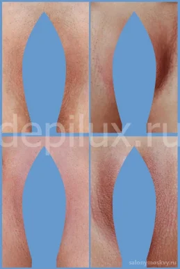 Студия здоровья и красоты Депилюкс