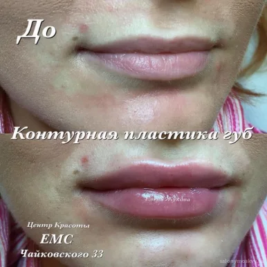 Центр эстетической медицины Емс