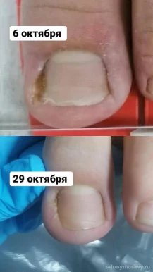 Кабинет аппаратного педикюра PodoEstet