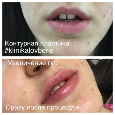 Косметологический центр Lovberis на Комендантском проспекте