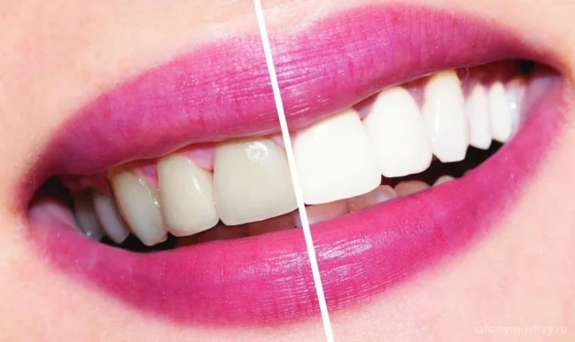 Студия My Brilliant smile