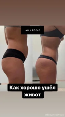 Студия массажа Bodysculpt